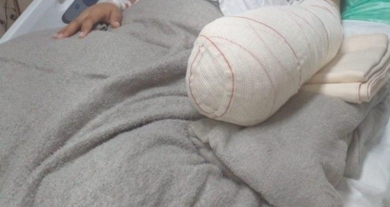 Jovem tem mão amputada após parto normal e vira caso de polícia.
