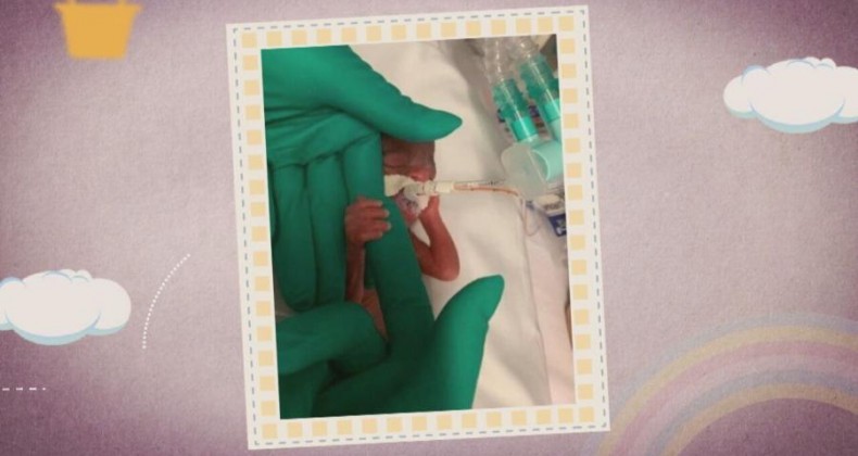 Bebê que nasceu com 25 cm recebe alta após 5 meses.